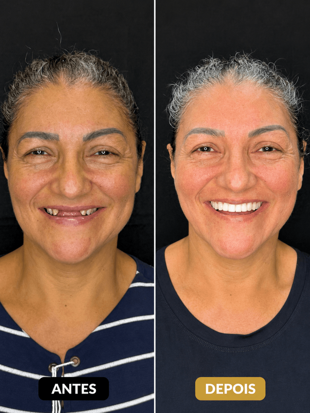 Prótese dentária — Dra. Elisangela, Porto Velho